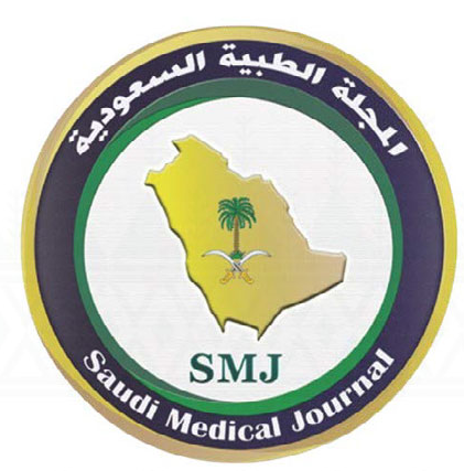 SMJ